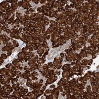 Anti-CRELD1 antibody produced in rabbit 