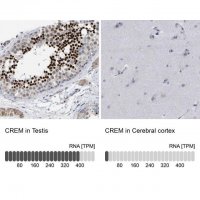 Anti-CREM antibody produced in rabbit