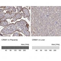 Anti-CRIM1 antibody produced in rabbit 
