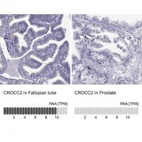 Anti-CROCC2 antibody produced in rabbit 