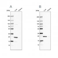 Anti-CRP antibody produced in rabbit 