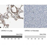 Anti-CRTAC1 antibody produced in rabbit 