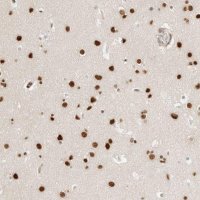 Anti-CRTC2 antibody produced in rabbit 