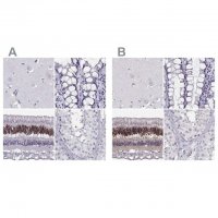 Anti-CRX antibody produced in rabbit