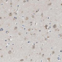 Anti-CSDE1 antibody produced in rabbit 
