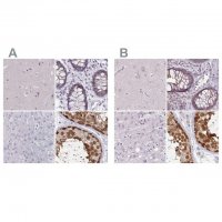 Anti-CSE1L antibody produced in rabbit