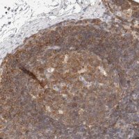 Anti-CSK antibody produced in rabbit