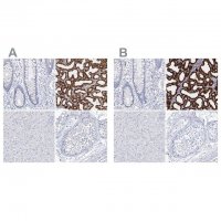 Anti-CSN3 antibody produced in rabbit 