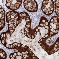 Anti-CSNK1G2 antibody produced in rabbit HPA034868-100UL
