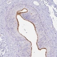 Anti-CST11 antibody produced in rabbit