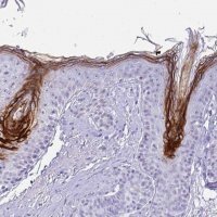 Anti-CST6 antibody produced in rabbit