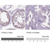 Anti-CTAG2 antibody produced in rabbit