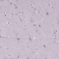 Anti-CTAG2 antibody produced in rabbit