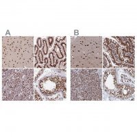 Anti-CTB-50L17.10 antibody produced in rabbit
