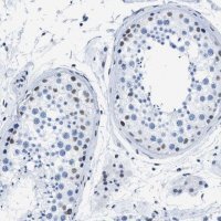 Anti-CTBP1 antibody produced in rabbit