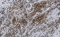 Anti-CTCF antibody, clone 1B18, ZooMAb� Rabbit monoclonal 