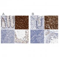 Anti-CTH antibody produced in rabbit 