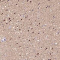 Anti-CTNND2 antibody produced in rabbit