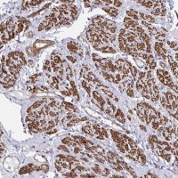 Anti-CTPS1 antibody produced in rabbit HPA051322-100UL