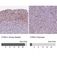 Anti-CTR9 antibody produced in rabbit 