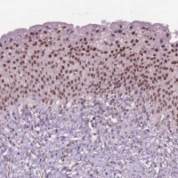 Anti-CTR9 antibody produced in rabbit 