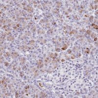 Anti-CTRC antibody produced in rabbit