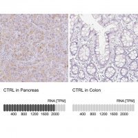 Anti-CTRL antibody produced in rabbit 