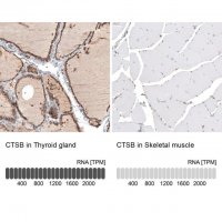 Anti-CTSB antibody produced in rabbit