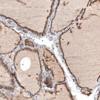 Anti-CTSB antibody produced in rabbit