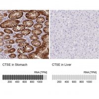 Anti-CTSE antibody produced in rabbit HPA012940-100UL