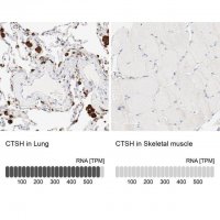Anti-CTSH antibody produced in rabbit 