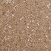 Anti-CUEDC1 antibody produced in rabbit 