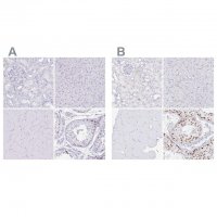 Anti-CXorf67 antibody produced in rabbit 