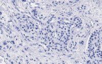 Anti-Cyclin D1 Antibody, clone 1J9, ZooMAb� Rabbit Monoclonal 