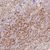 Anti-CYP11B2 antibody produced in rabbit