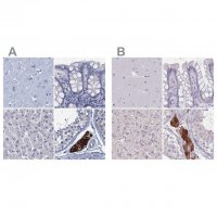 Anti-CYP51A1 antibody produced in rabbit 