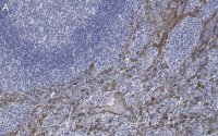Anti-Cytokeratin 5/6 Antibody, clone D5/16 B4 ZooMAb� Mouse Monoclonal 