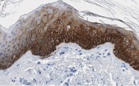 Anti-Cytokeratin-14 Antibody, clone 1D15 ZooMAb� Rabbit Monoclonal 