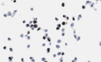 Anti-Cytomegalovirus Antibody, clone 8B1.2 ZooMAb� Mouse Monoclonal 
