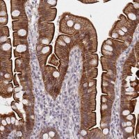 Anti-DAB1 antibody produced in rabbit