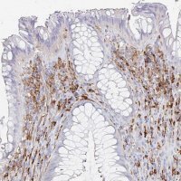 Anti-DAB2 antibody produced in rabbit 