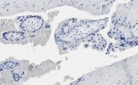Anti-DAP Kinase 1 Antibody, clone 1J22 ZooMAb� Rabbit Monoclonal 
