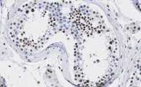 Anti-DAXX Antibody, clone 1L6 ZooMAb� Rabbit Monoclonal 