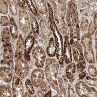 Anti-DCAF11 antibody produced in rabbit