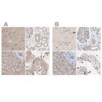 Anti-DCAF7 antibody produced in rabbit 