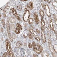 Anti-DCDC2 antibody produced in rabbit