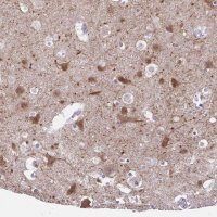 Anti-DCLK2 antibody produced in rabbit 