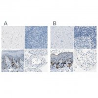 Anti-DCT antibody produced in rabbit