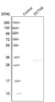 Anti-DCTN6 antibody produced in rabbit HPA024049-100UL