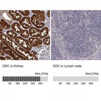 Anti-DDC antibody produced in rabbit HPA017742-100UL